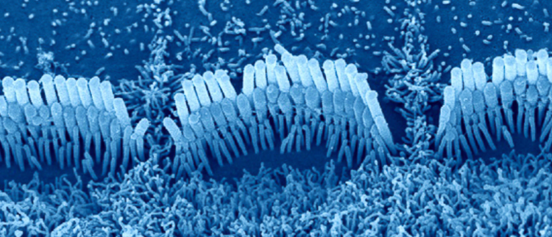 hair cell